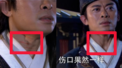 脖子傷痕突然消失